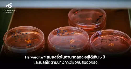 Harvard Scientists Grow Tiny Brain Organoids That Survive Over 5 Years and Develop on Same Timeline as Real Brain